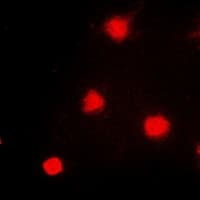 NAT5 / NAA20 Antibody
