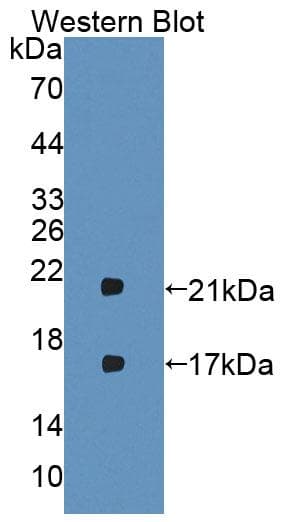 IFN Beta / Interferon Beta Antibody (aa23-169)
