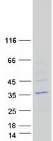 Human OPPO1 / ODF4 Protein (Recombinant Myc-DDK (Flag))