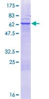 Human ABHD17A / FAM108A1 Protein (Recombinant GST)