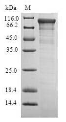 Escherichia coli ADCY6 / Adenylate Cyclase 6 Protein (Recombinant 6His, N-terminus)