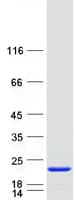 Human HPCAL4 Protein (Recombinant Myc-DDK (Flag))