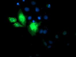 CYB5R3 / B5R Antibody (clone OTI1E8)