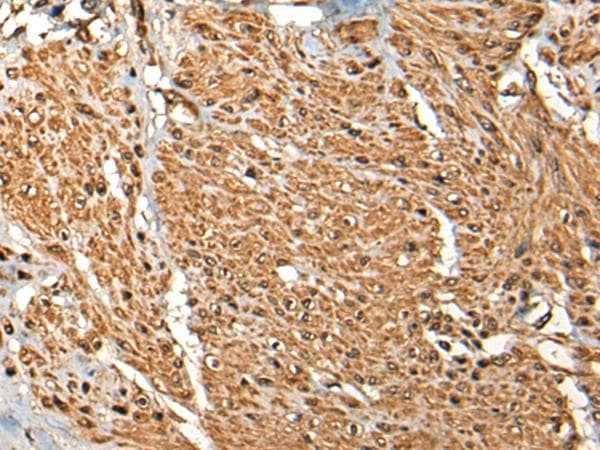 Polyclonal Rabbit anti-Human MICU1 / CBARA1 Antibody (IHC)