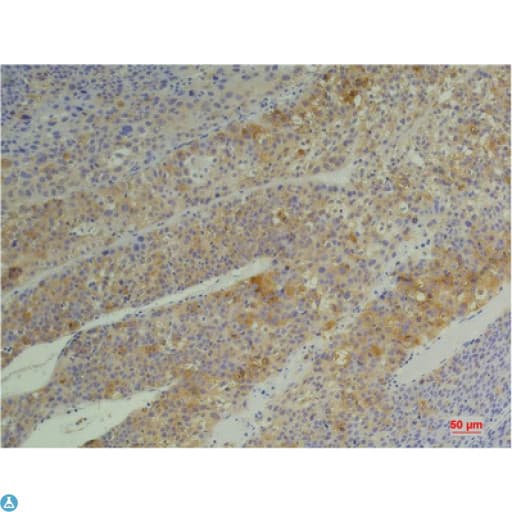 Monoclonal Mouse anti-Human PPIB / Cyclophilin B Antibody (IHC, WB)