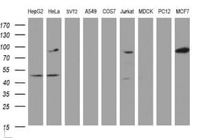 ATRIP Antibody (clone OTI1G6)