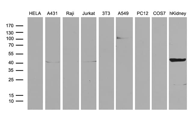 ASS1 / ASS Antibody (C-Terminus, clone OTI3D1)