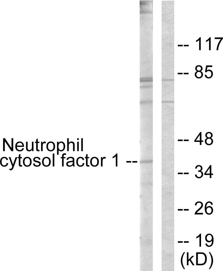 NCF1 / p47phox / p47 phox Antibody (p304)