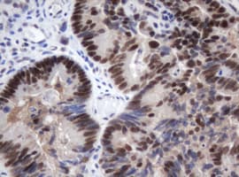 Monoclonal Mouse anti-Human METTL16 / METT10D Antibody (clone OTI3E8, IHC, WB)