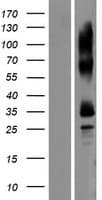 TEDDM1 Protein (Over-Expression Lysate Myc-DDK (Flag))