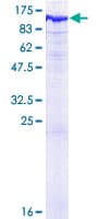 Human INPP5B Protein (Recombinant GST)
