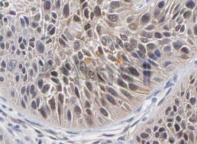 RELA / NFKB p65 Antibody