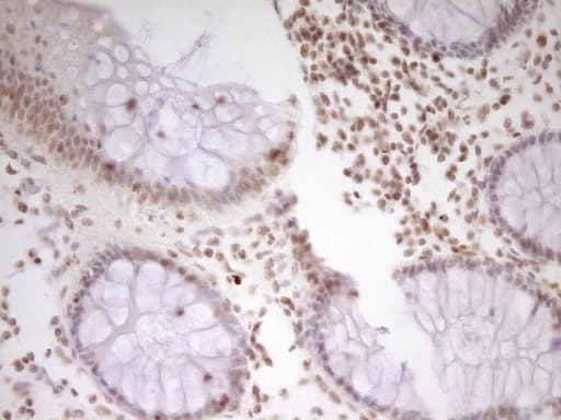 NR2C2 / TAK1 Antibody (aa1-241, clone OTI1F3)