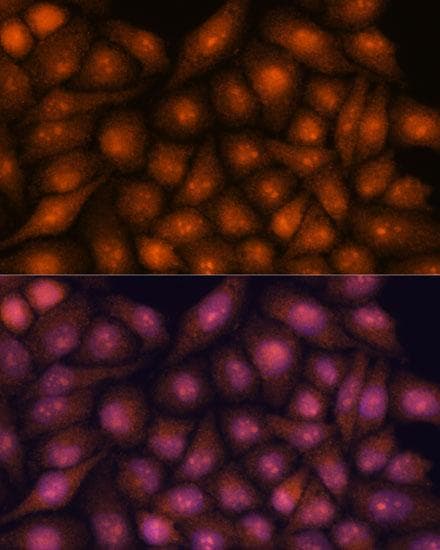 DDX31 Antibody