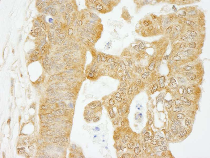 Polyclonal Rabbit anti-Human EIF4G1 / EIF4G Antibody (aa525-575, IHC, WB)