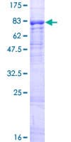 Human MCMDC2 / C8orf45 Protein (Recombinant GST)