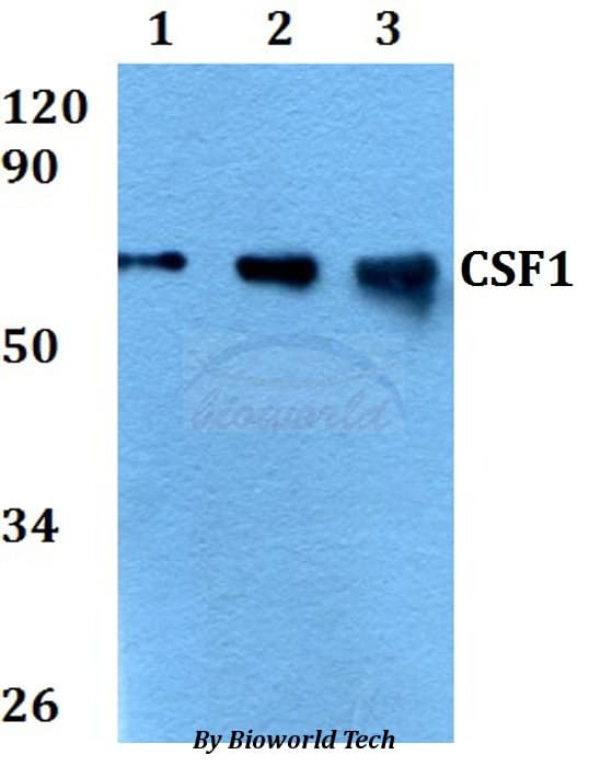 CSF1 / MCSF Antibody