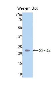 TDP-43 / TARDBP Antibody (aa104-262)