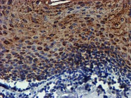 PDSS2 / DLP1 Antibody (clone OTI1C11)