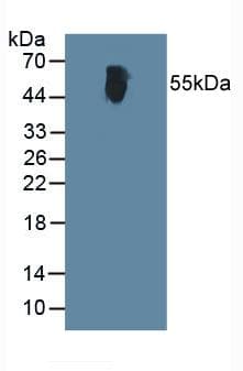 GPT / Alanine Transaminase Antibody (aa367-480)