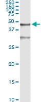 Monoclonal Mouse anti-Human SERPINB3 Antibody (clone 2F5, WB)