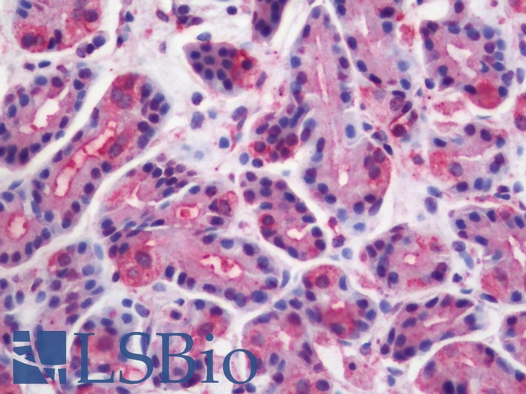 IHC-plus™ WNT10A Antibody (Internal)