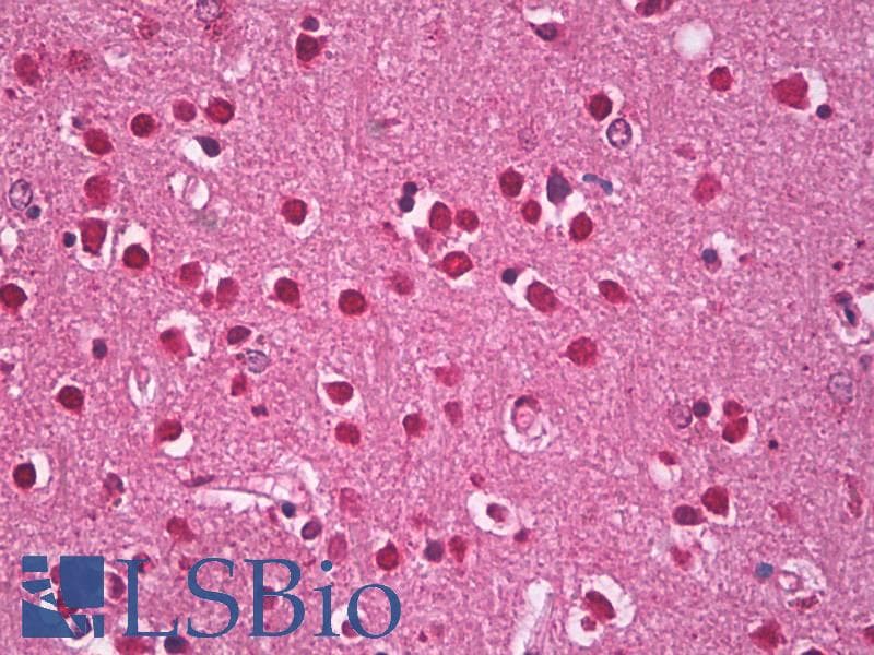 IHC-plus™ AHSA1 / AHA1 Antibody