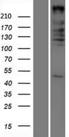 ARID1A / BAF250 Protein (Over-Expression Lysate Myc-DDK (Flag))