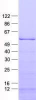 Human KBTBD4 Protein (Recombinant His, N-Terminal)