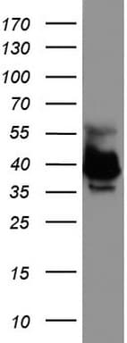 EPCAM Antibody (clone UMAB132)