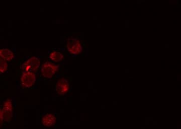 EPCAM Antibody