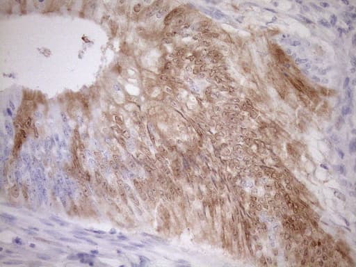 p16INK4a / CDKN2A Antibody (clone OTI7B10)