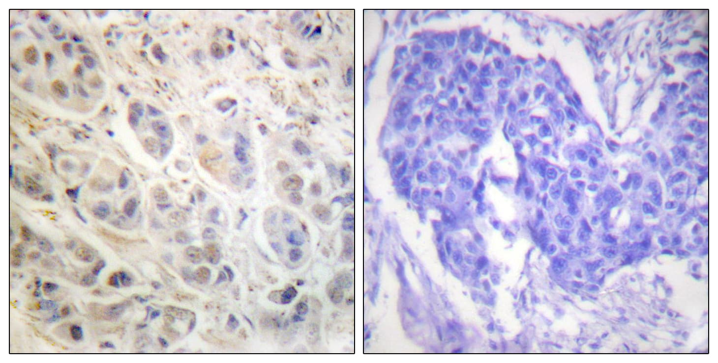 Polyclonal Rabbit anti-Human RPS6KA1 / RSK1 Antibody (aa539-588, IHC, IF, WB)