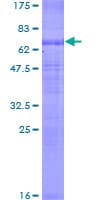 Human SLC12A1 / NKCC2 Protein (Recombinant GST)