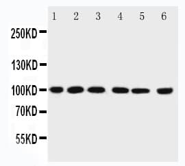 PIAS1 Antibody (aa636-651)