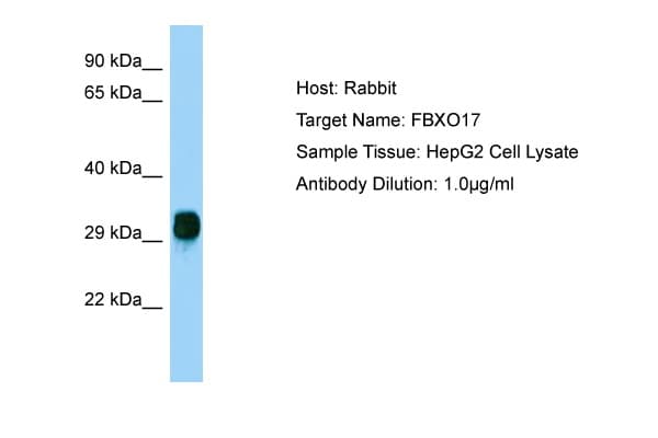 FBG4 / FBXO17 Antibody (aa36-85)