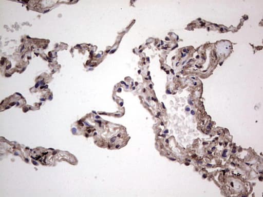 Monoclonal Mouse anti-Human SAE1 Antibody (clone OTI6B11, Carrier-free, IHC, WB)