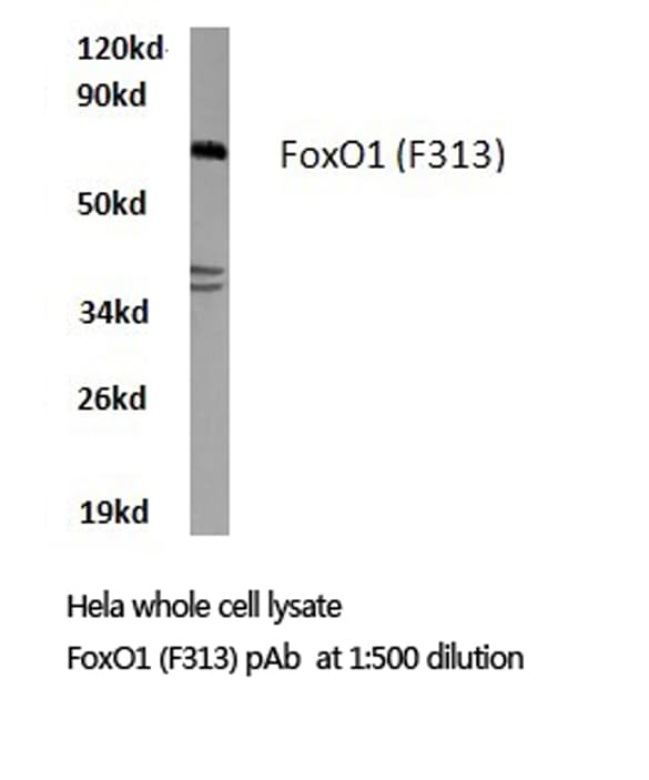 FOXO1 / FKHR Antibody (Phe313)