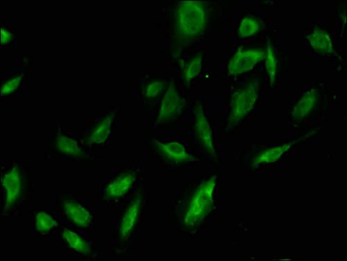 Polyclonal Rabbit anti-Human MTAP Antibody (IF, WB)