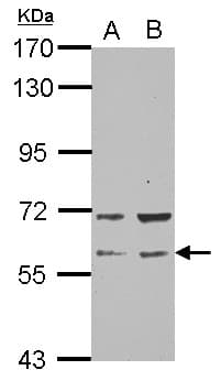 RAP1GDS1 / SmgGDS Antibody (N-Terminus)