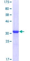 Human CKS2 Protein (Recombinant GST)