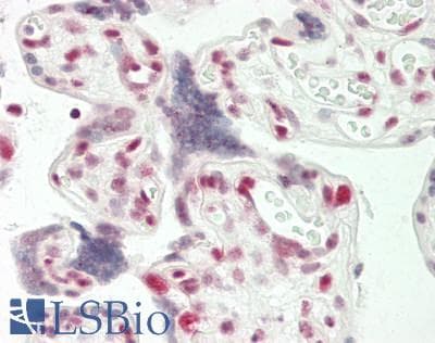 IHC-plus™ MEF2C Antibody (aa362-411)