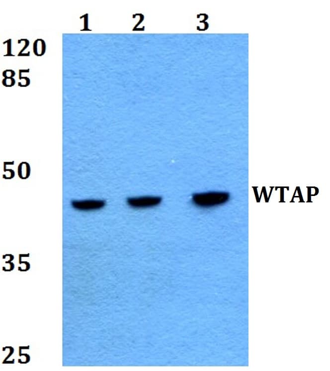 IHC-plus™ WTAP Antibody (His351)