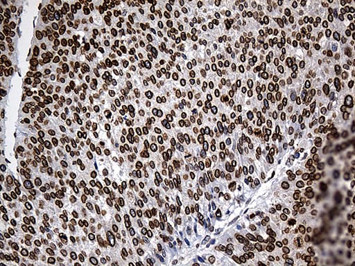 SLU7 / 9G8 Antibody (aa1-300, clone OTI6B1)