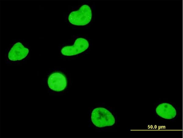 IHC-plus™ SGK1 / SGK Antibody (clone 3E3)
