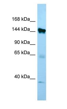 Polyclonal Rabbit anti-Human EMILIN1 / EMI Antibody (aa671-720, WB)