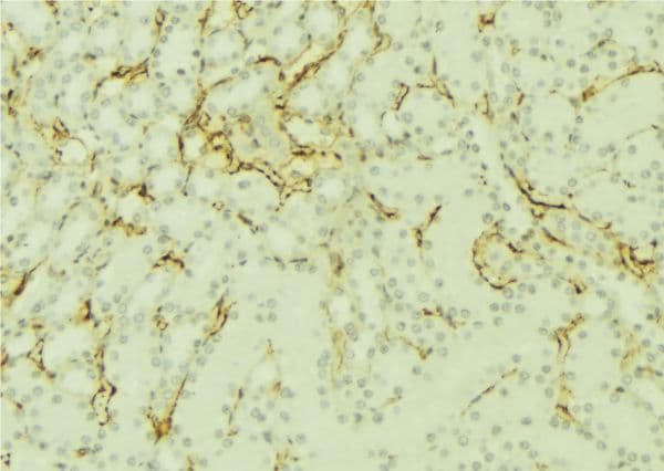 SORD / Sorbitol Dehydrogenase Antibody