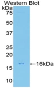 LGALS7 / Galectin 7 Antibody (aa1-128)
