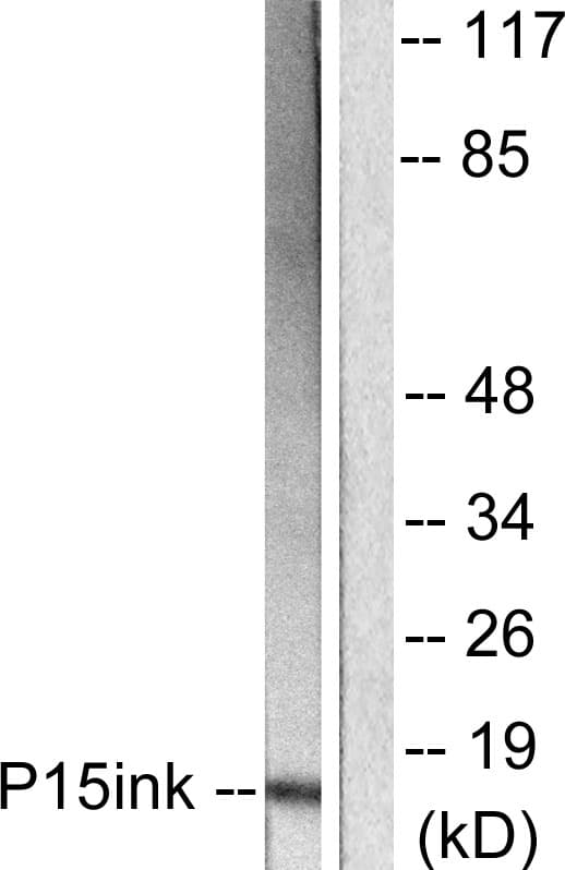 CDKN2B / p15 INK4b Antibody (aa89-138)