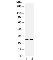 Polyclonal Rabbit anti-Human PSMA2 Antibody (WB)